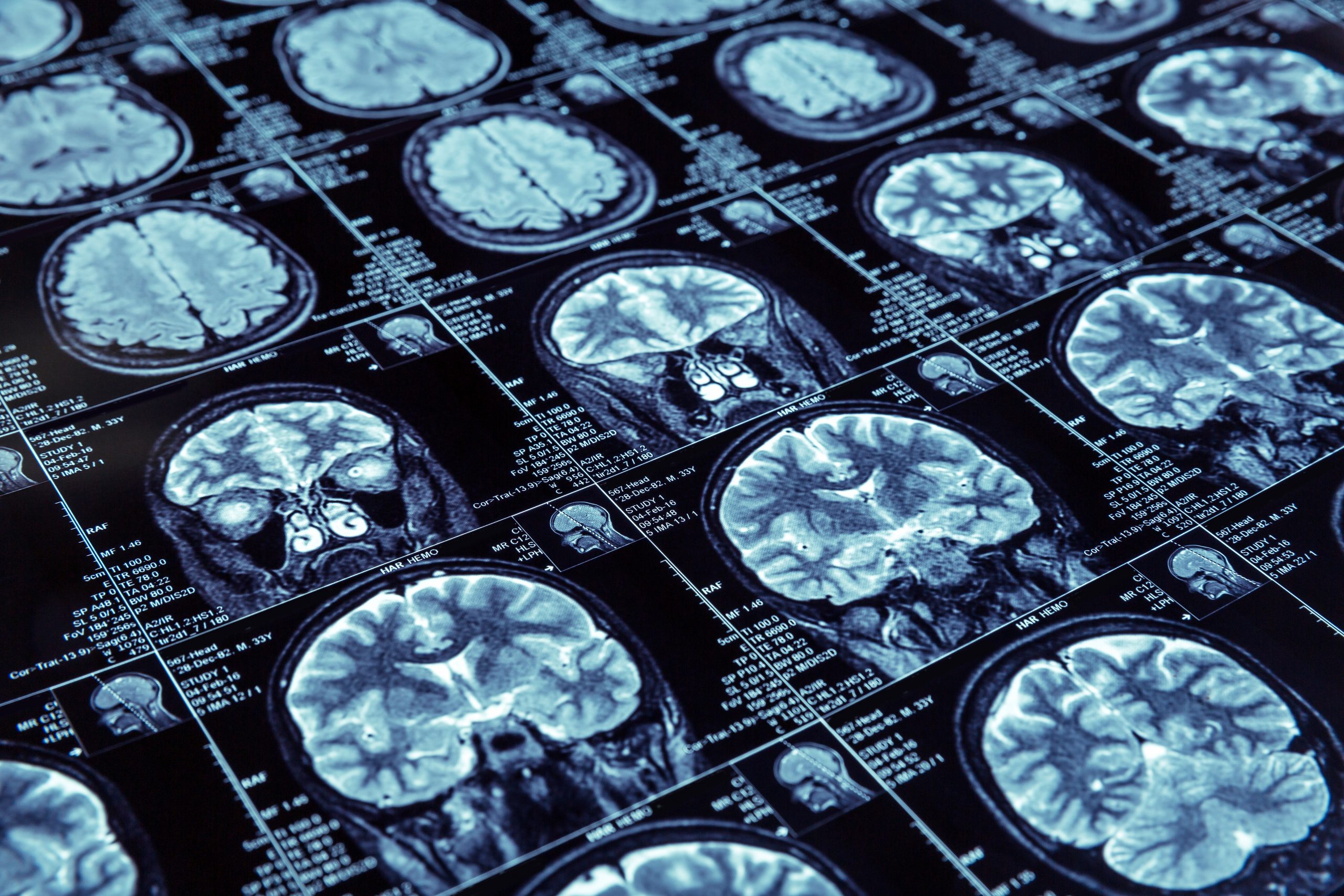 Medical Imaging